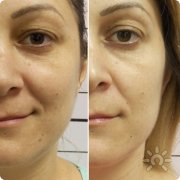 Анна, 33 года