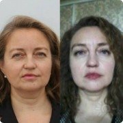 Результат до&nbsp;и после(5 месяцев)