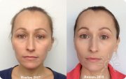 Мой личный результат за&nbsp;3 месяца