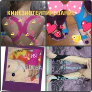 Кинезиотейпирование