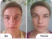 Фото до