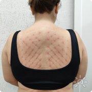 На острие | Студия экстремальной йоги