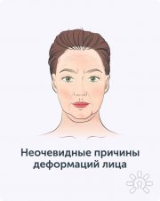 Про брыли и&nbsp;почему они не&nbsp;"появляются внезапно"